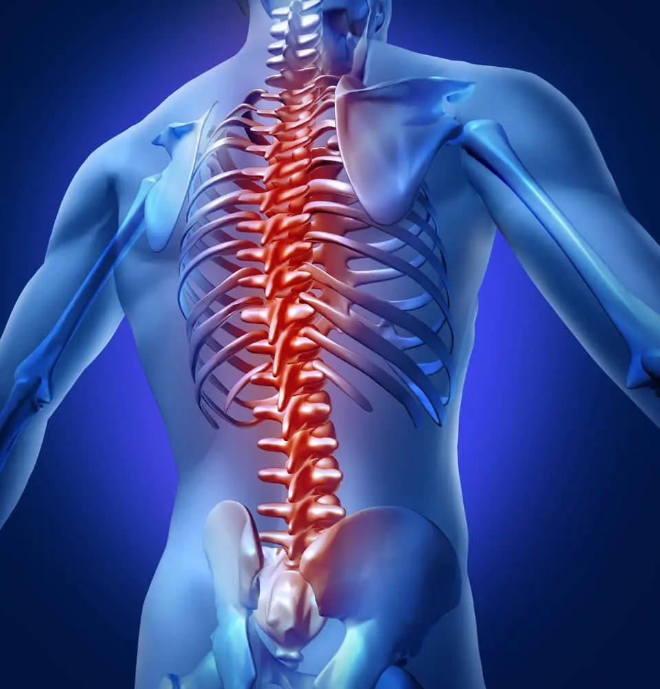 What is Spinal Canal Narrowing in the Waist, Back and Neck?