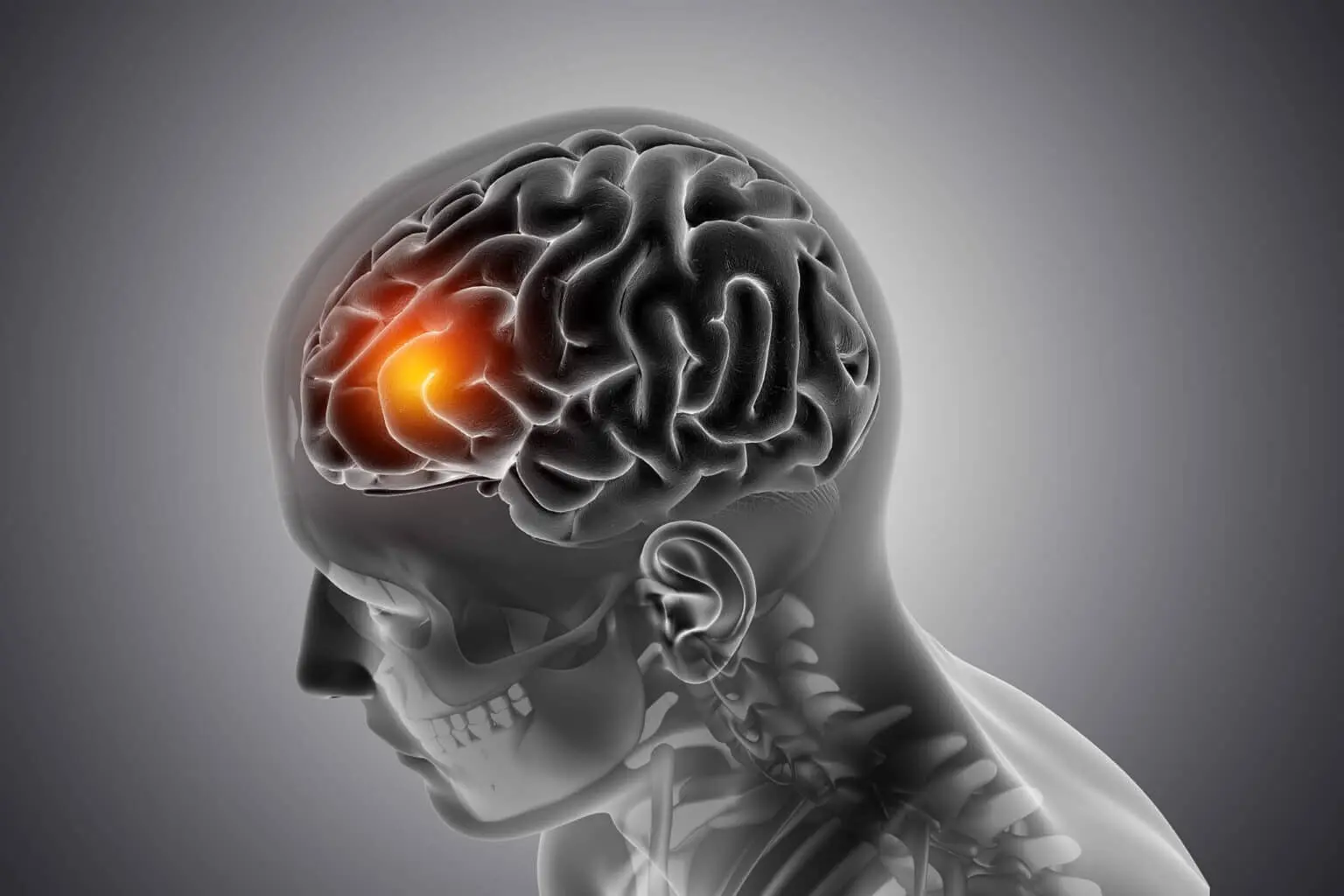 Why Child Brain Tumors Are Different From Adults?